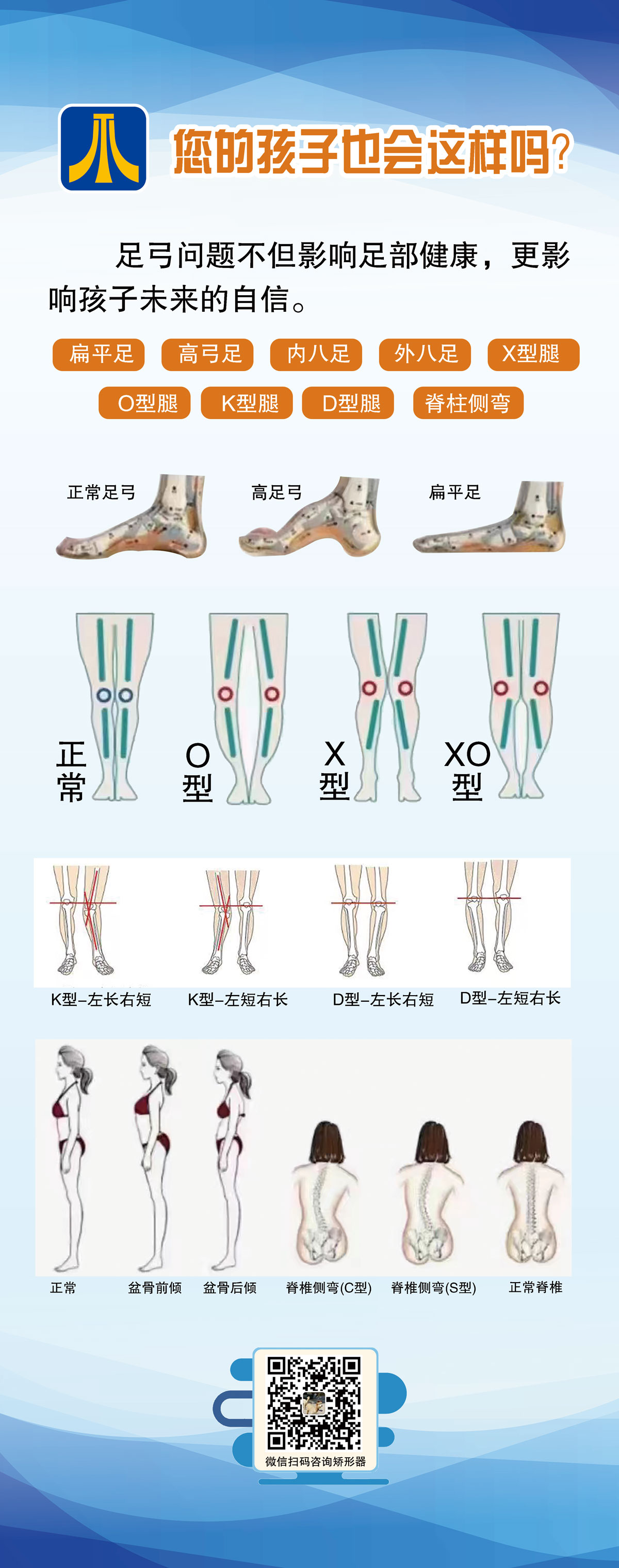 足弓問題不但影響足部健康，更影響孩子未來的自信.jpg